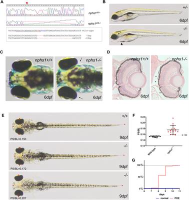 A zebrafish model of congenital nephrotic syndrome of the Finnish type